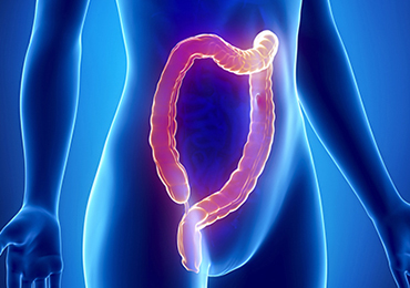 ¿A qué edad debo revisar el colon?