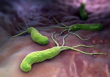 La bacteria Helicobacter pylori puede ser responsable de la aparición de halitosis
