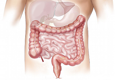 Permeabilidad intestinal: ¿sabes qué es y cómo puede ayudarte la alimentación a tratarla?