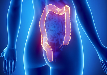 Fístulas y abscesos anales