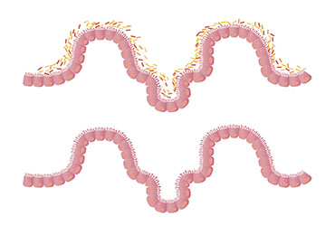 La microbiota es capaz de hacerte más fuerte frente a las infecciones