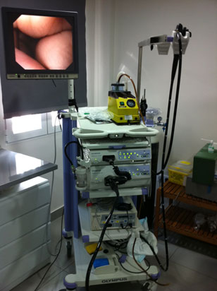 Endoscopio